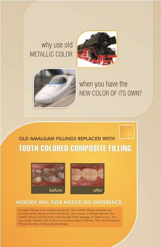 Poster English Tooth Coloured Composite Filling - 033 - Libral Traders
