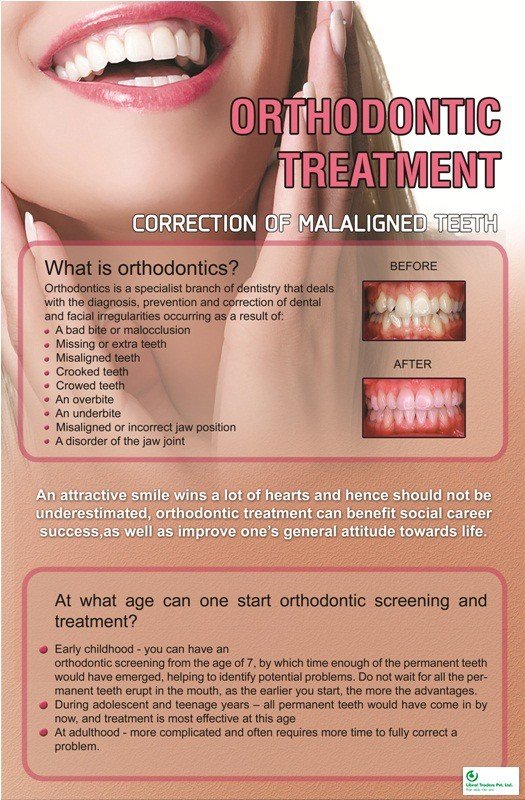 Poster English Orthodontic Treatment - 044 - Libral Traders