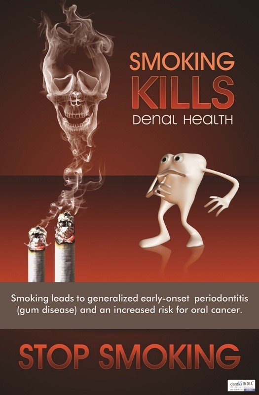 Poster English Smoking Kills Dental Health - 062 - Libral Traders
