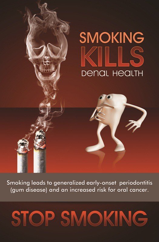 Poster English Smoking Kills Dental Health - 062 - Libral Traders