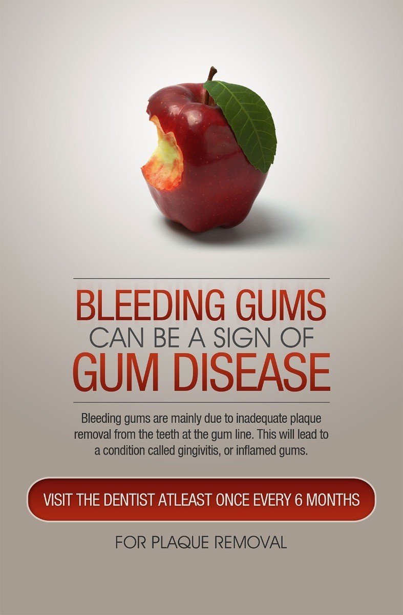 Poster English Bleeding Gems Can Be Sign of Gum Disease  - 080 - Libral Traders