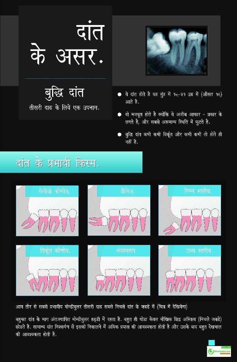 Poster Hindi दांत के असर  - 003 - Libral Traders
