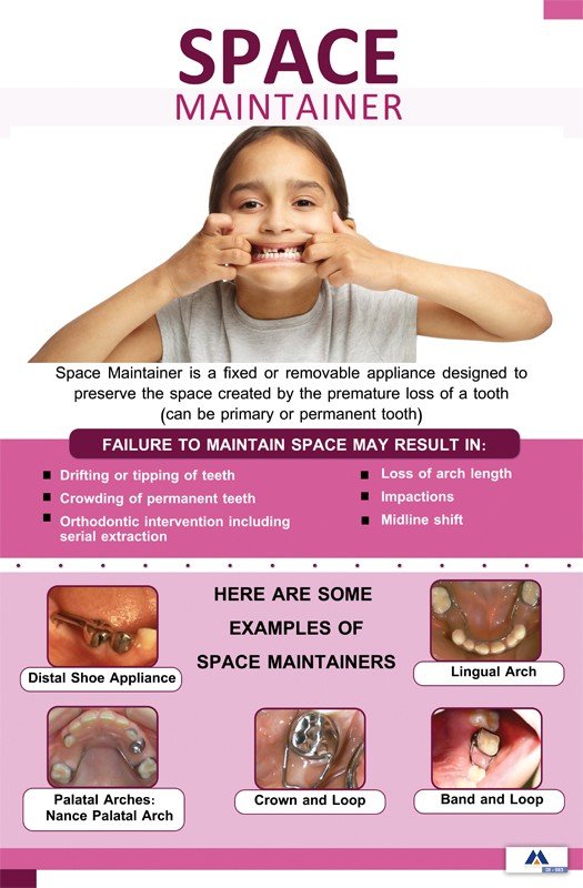 Poster English Space Maintainer - 083 - Libral Traders