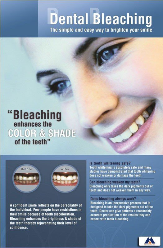 Poster English Dental Bleaching - 019 - Libral Traders