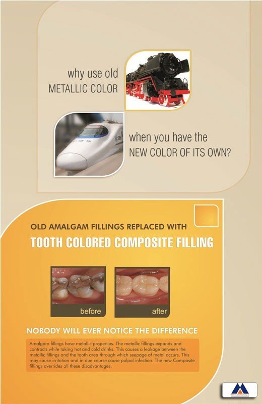 Poster English Tooth Coloured Composite Filling - 033 - Libral Traders