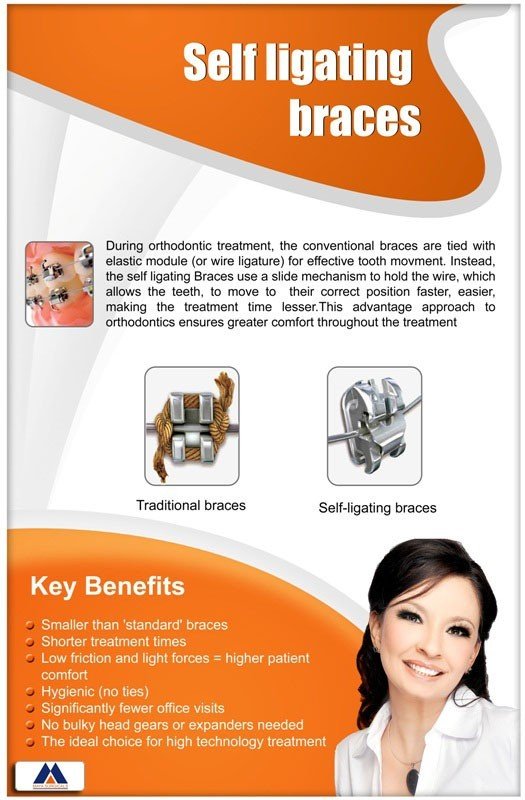 Poster English Orthodontic Self Ligating Braces - 037 - Libral Traders