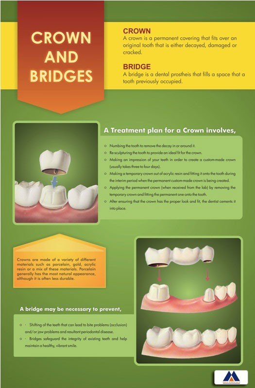 Poster English Crown And Bridges - 049 - Libral Traders