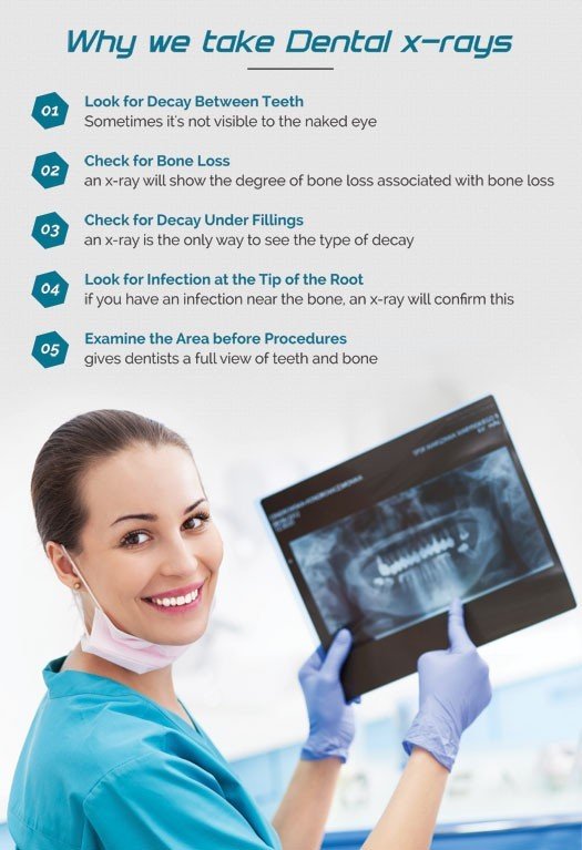 Poster English Dental X - Rays - 091 - Libral Traders