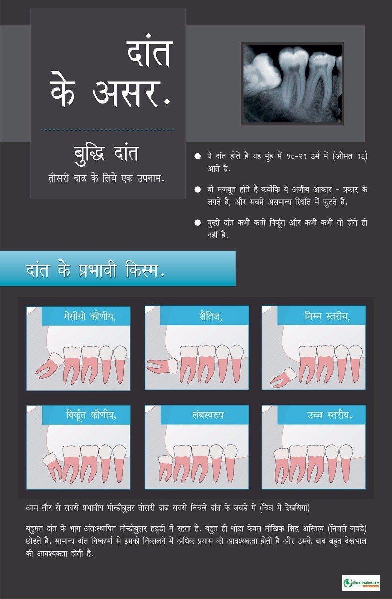 Poster Hindi दांत के असर  - 003 - Libral Traders