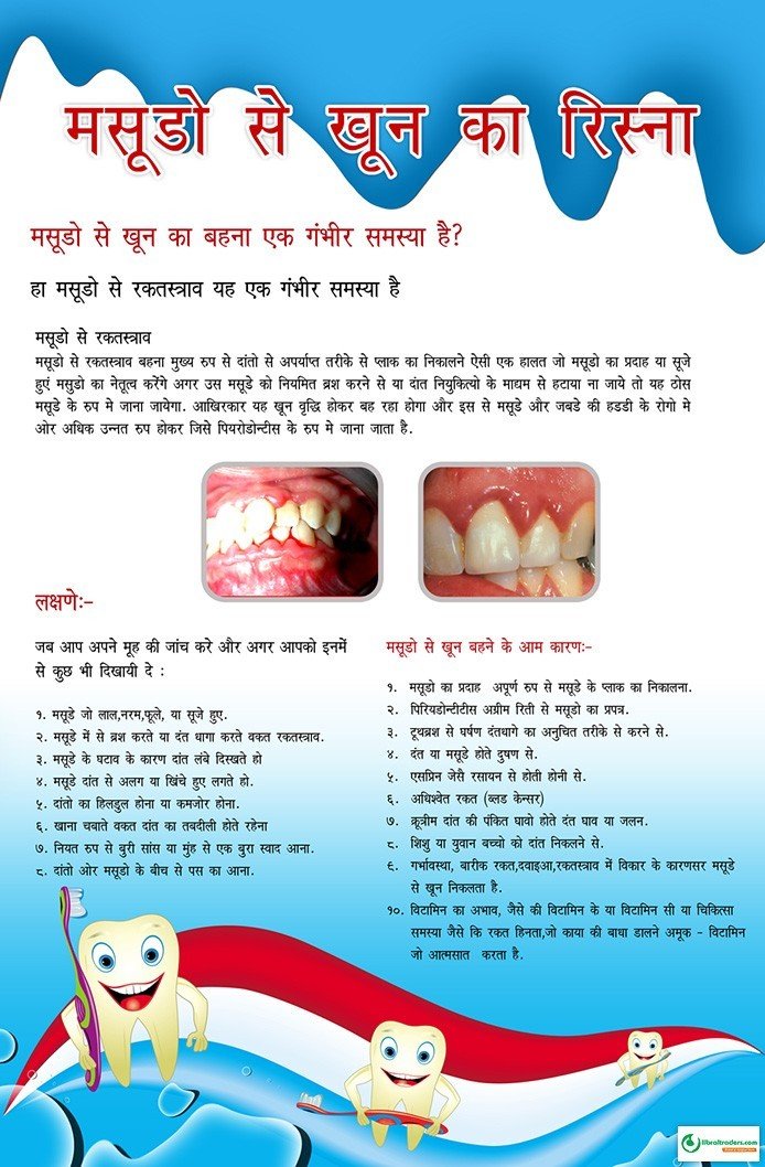 Poster Hindi मसूड़ो से खून का रिसना  - 021 - Libral Traders