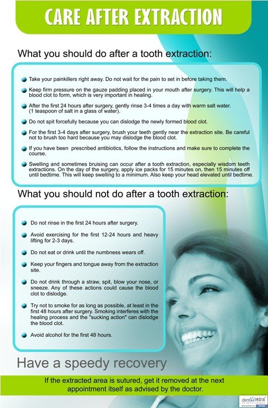Poster English Care After Extraction - 045 - Libral Traders