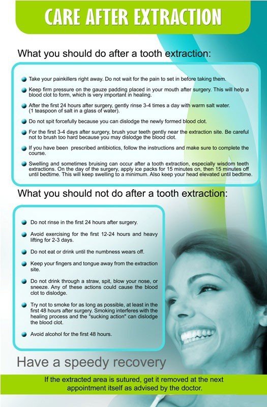Poster English Care After Extraction - 045 - Libral Traders