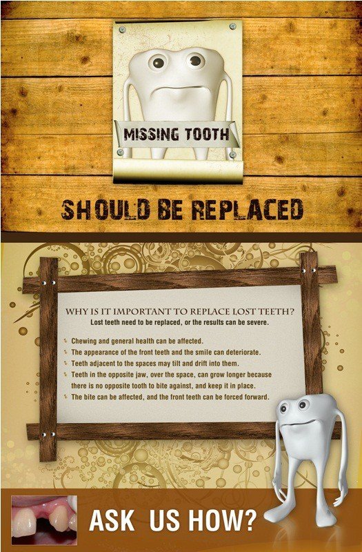Poster English Missing Tooth Should Be Replaced - 048 - Libral Traders