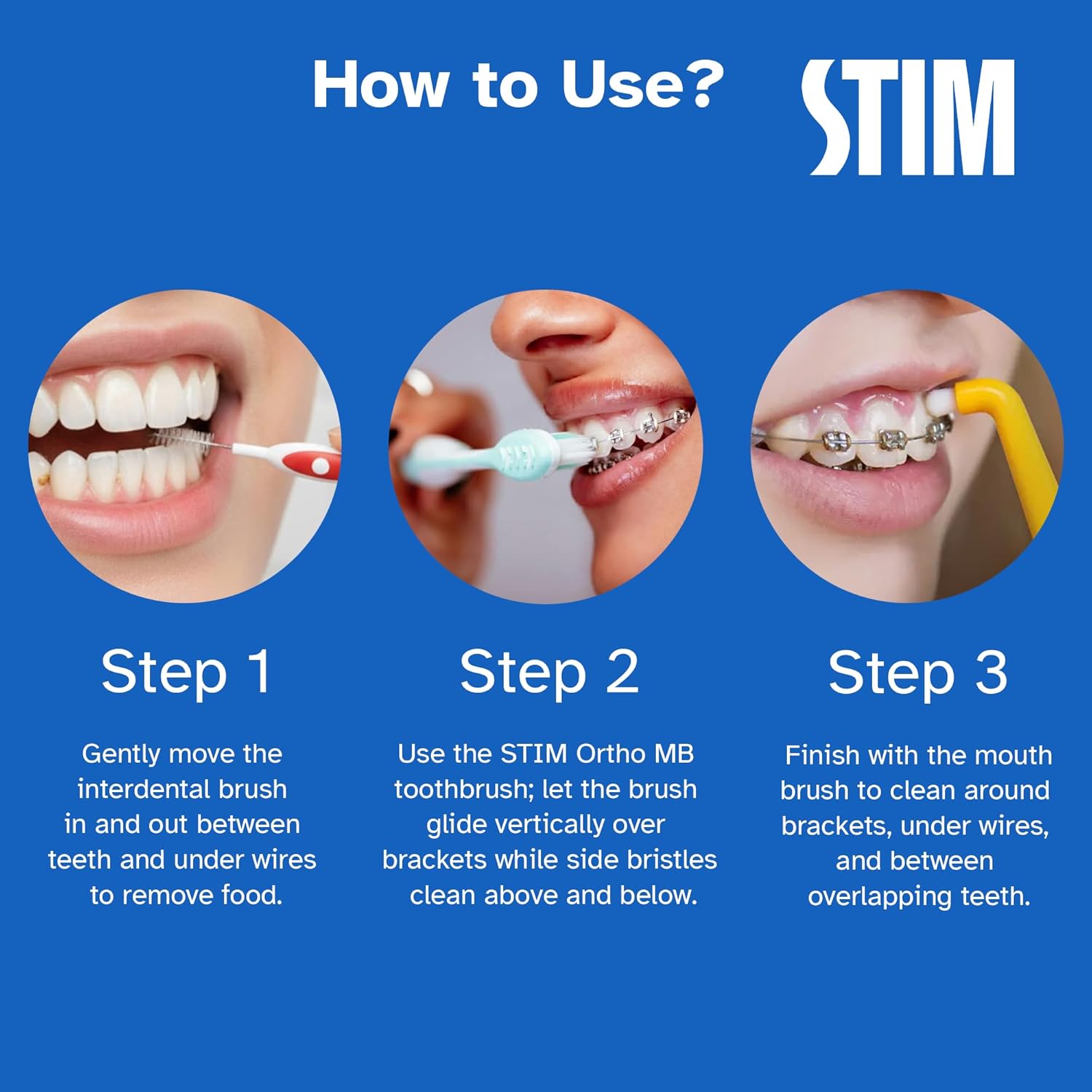 STIM Ortho MB manual toothbrush designed for braces, with specialized bristles for effective cleaning around orthodontic appliances.
