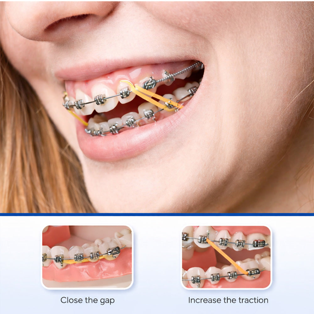 Captain Orthodontics Captain Ortho Tooth Colour Elastics in various colors, showing close-up of elastics on a dental display.