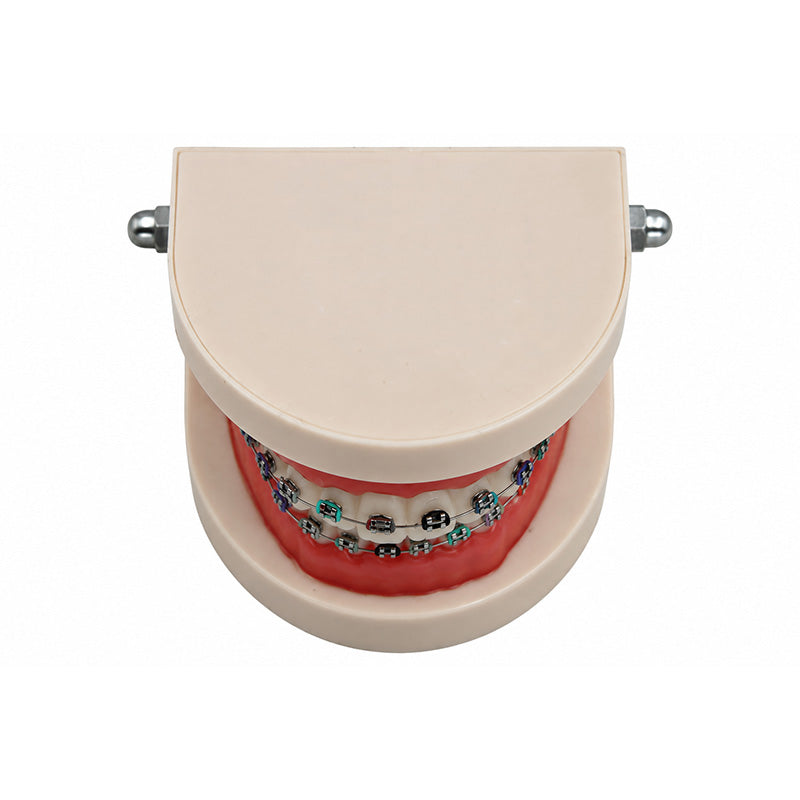 Libral Study Model With Centrino Mini Brackets