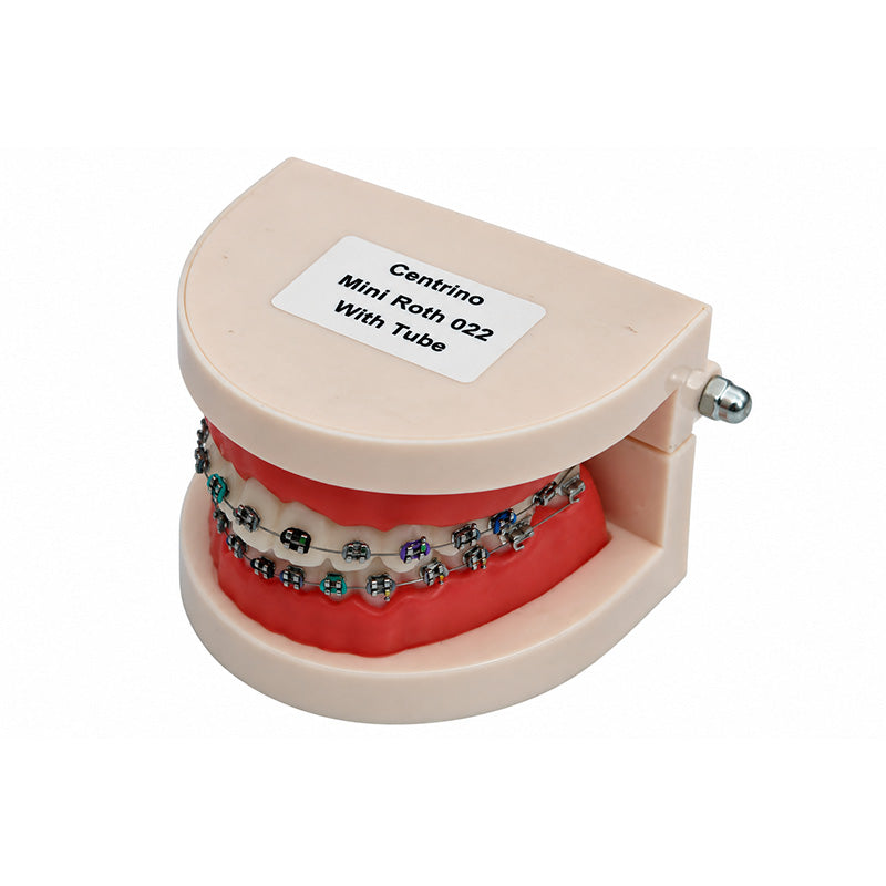 Libral Dental Study / Typodont Model With Centrino Mini Brackets