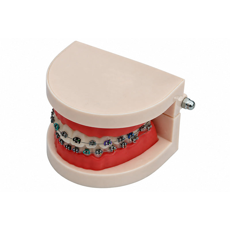 Libral Study Model With Centrino Mini Brackets