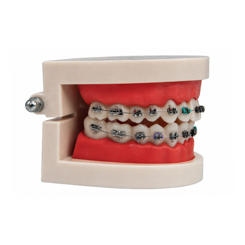 Libral Dental Study / Typodont Model With Centrino Mini Brackets
