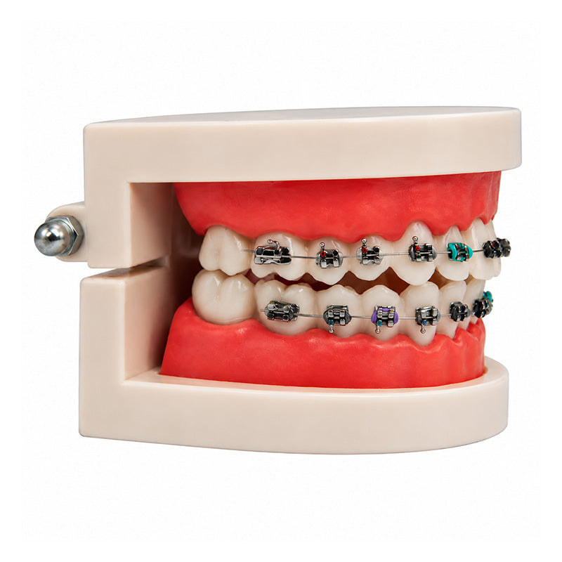 Libral Study Model With Centrino Mini Brackets