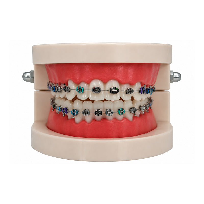 Libral Dental Study / Typodont Model With Centrino Mini Brackets