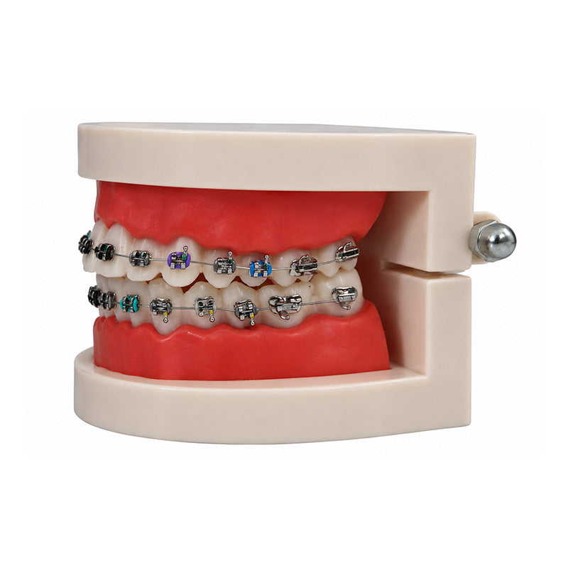 Libral Dental Study / Typodont Model With Centrino Mini Brackets