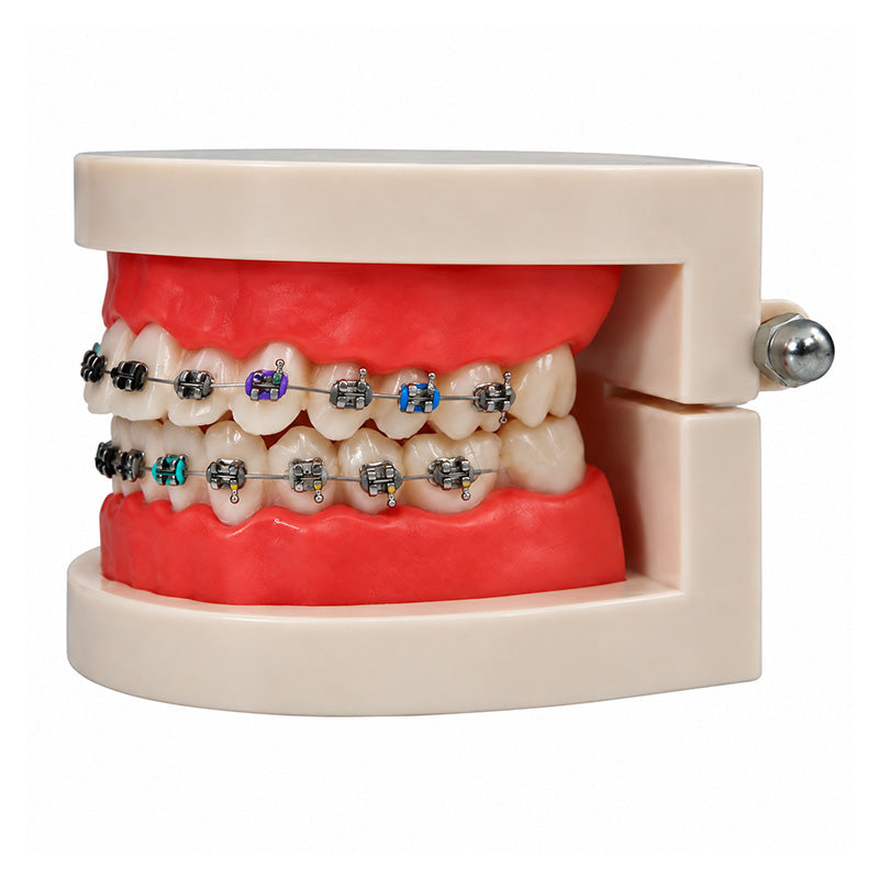 Libral Study Model With Centrino Mini Brackets