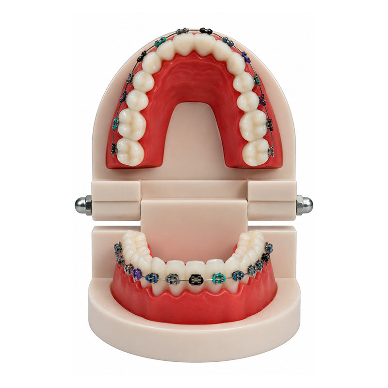 Libral Dental Study / Typodont Model With Centrino Mini Brackets