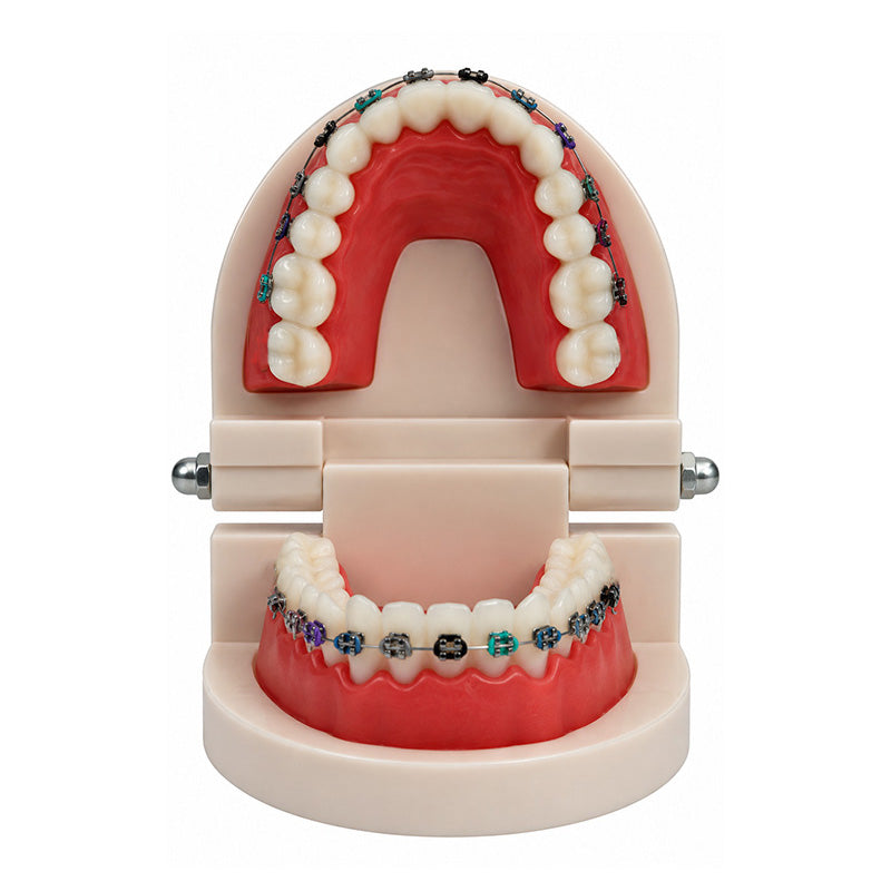 Libral Study Model With Centrino Mini Brackets