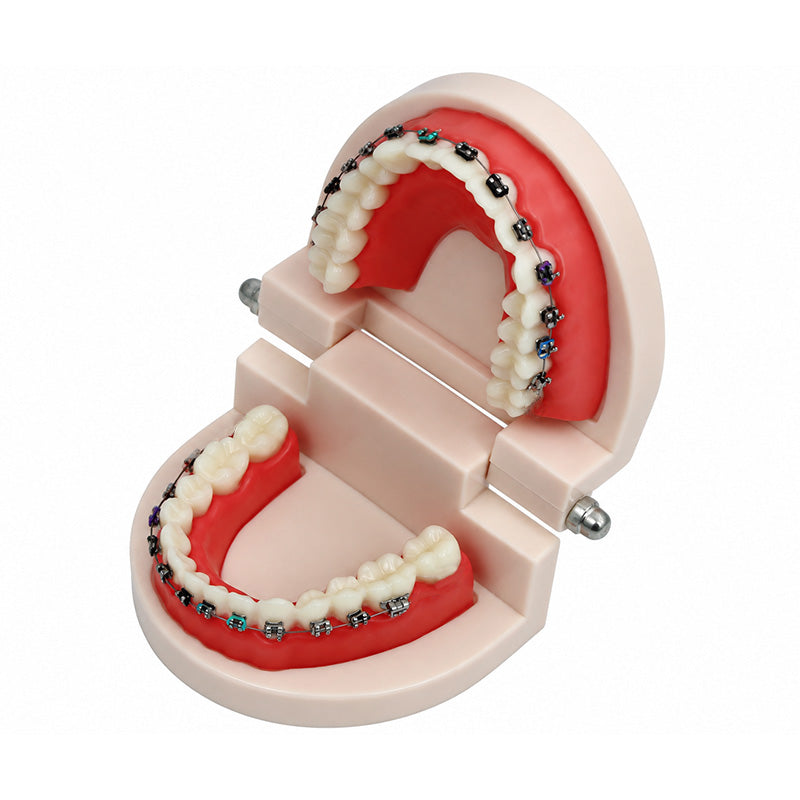 Libral Study Model With Centrino Mini Brackets