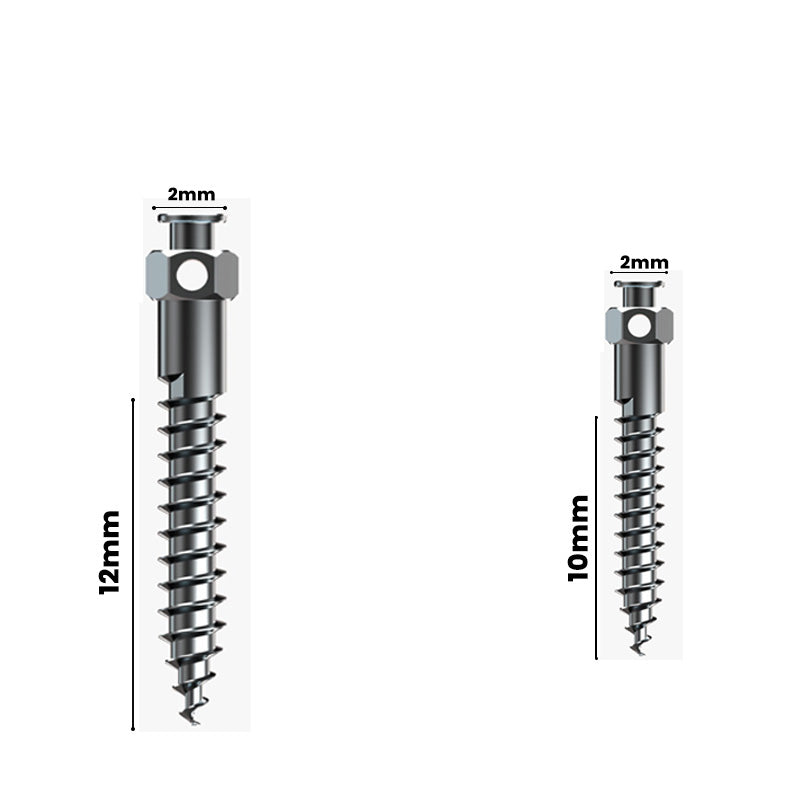 RF Mini Screws – Buccal Shelf Orthodontic Screws