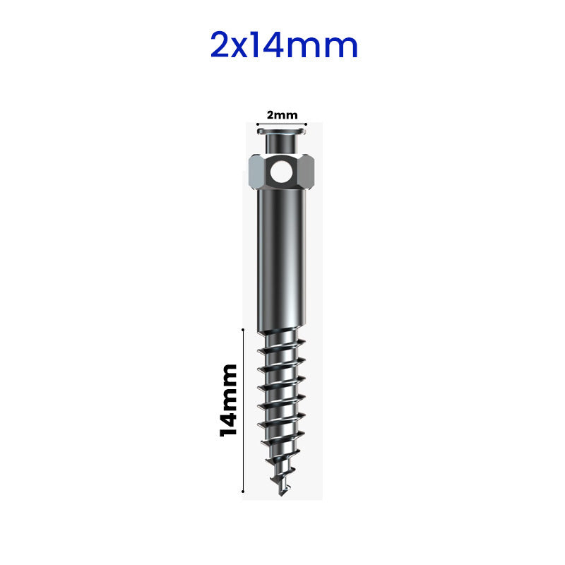 RF Mini Screws – Infra Zygomatic Orthodontic Screws