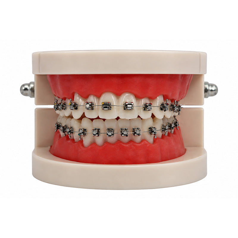 Captain Damon SL self-ligating orthodontic brackets with attached tubes and wires, shown in the product image.