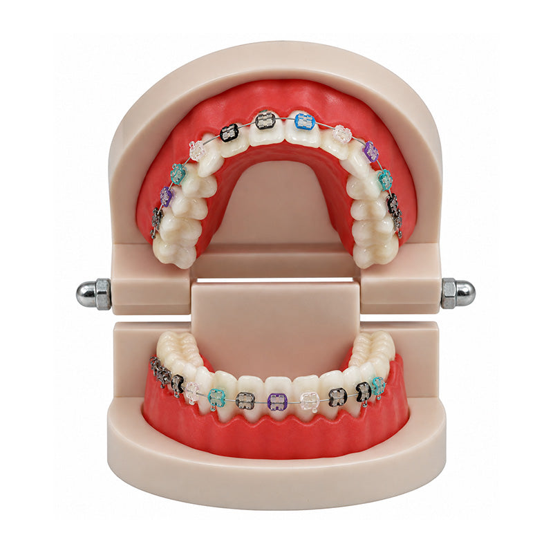 Libral® dental teeth study model featuring Osstem Perfect Clear 2 Sapphire Mono ceramic brackets for orthodontic demonstration.