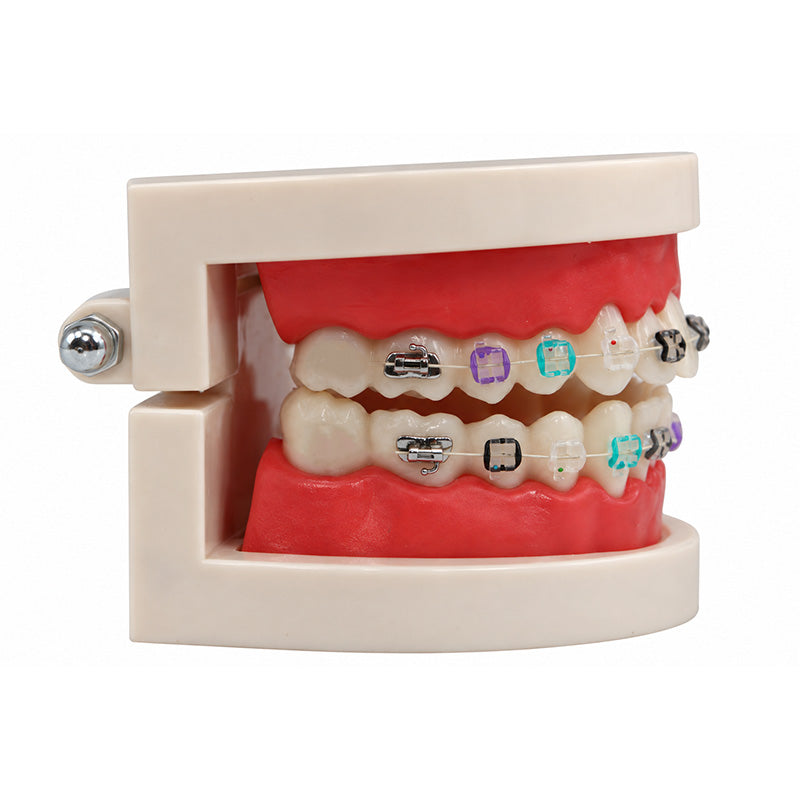 Libral ® dental study model featuring Osstem Perfect Clear 2 Sapphire Mono ceramic brackets on a realistic teeth display.
