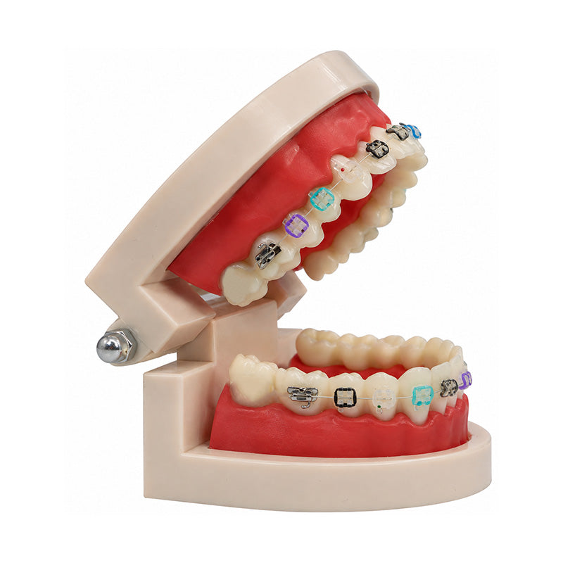 Libral study dental model with Osstem Perfect Clear 2 Sapphire Mono ceramic brackets for orthodontic demonstration.