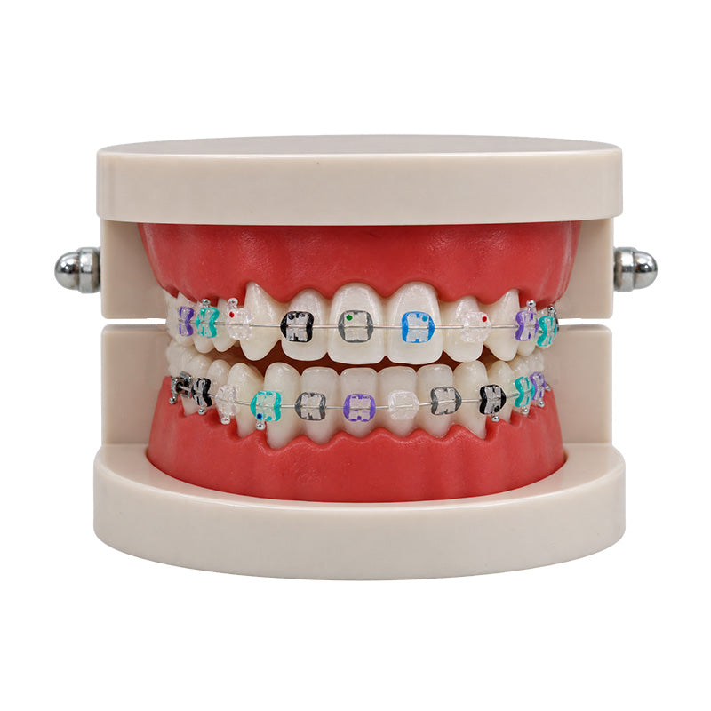Libral® dental teeth model with Osstem Perfect Clear 2 Sapphire Mono ceramic brackets for orthodontic study and demonstration.