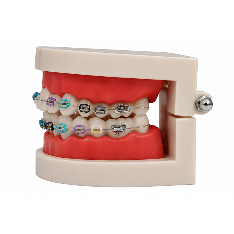 Libral® dental teeth model with Osstem OK resin and metal slot brackets, used for orthodontic study and demonstration.