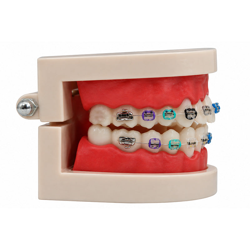 Libral® dental study model with Osstem OK resin and metal slot brackets, showing detailed teeth and orthodontic components.