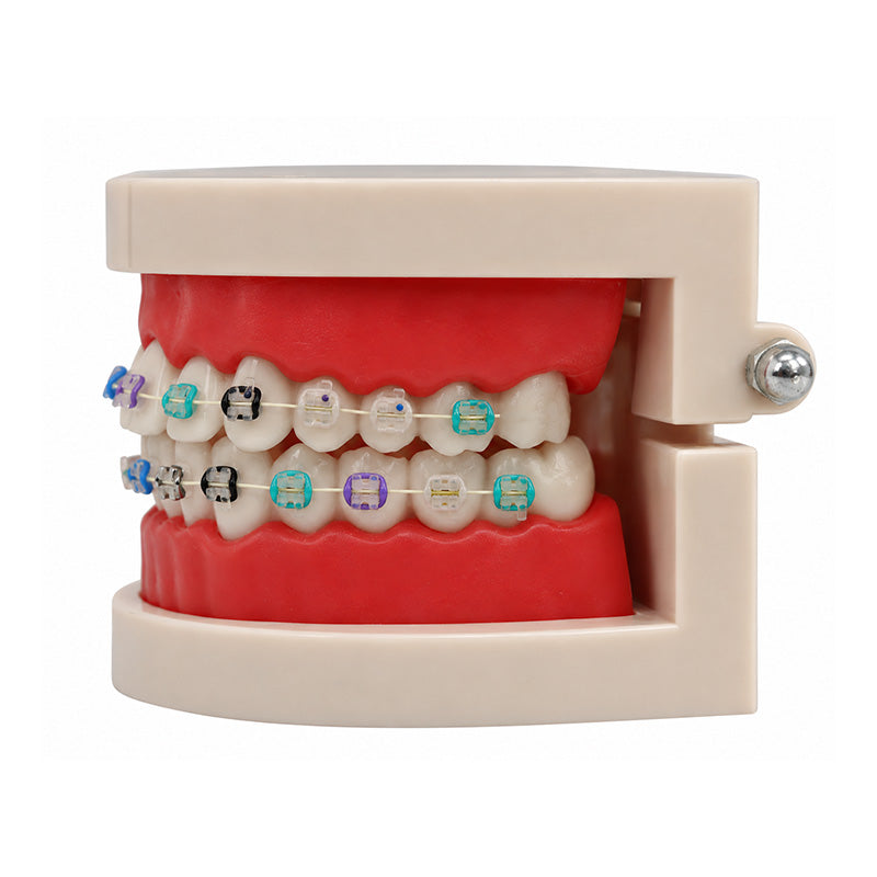 Libral Study Model With Axim Ceramic Brackets