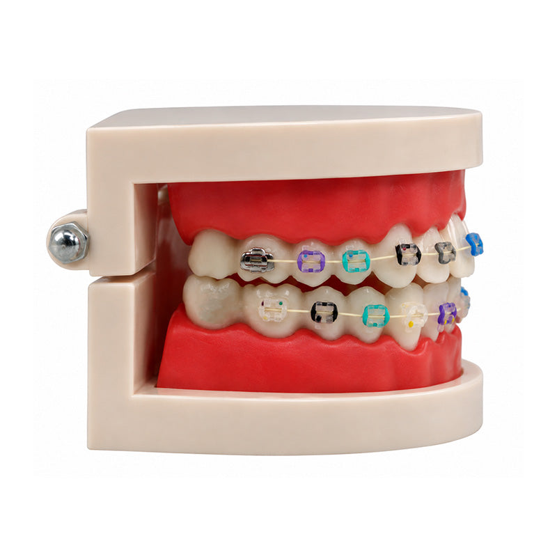 Libral Study Model With Axim Ceramic Brackets