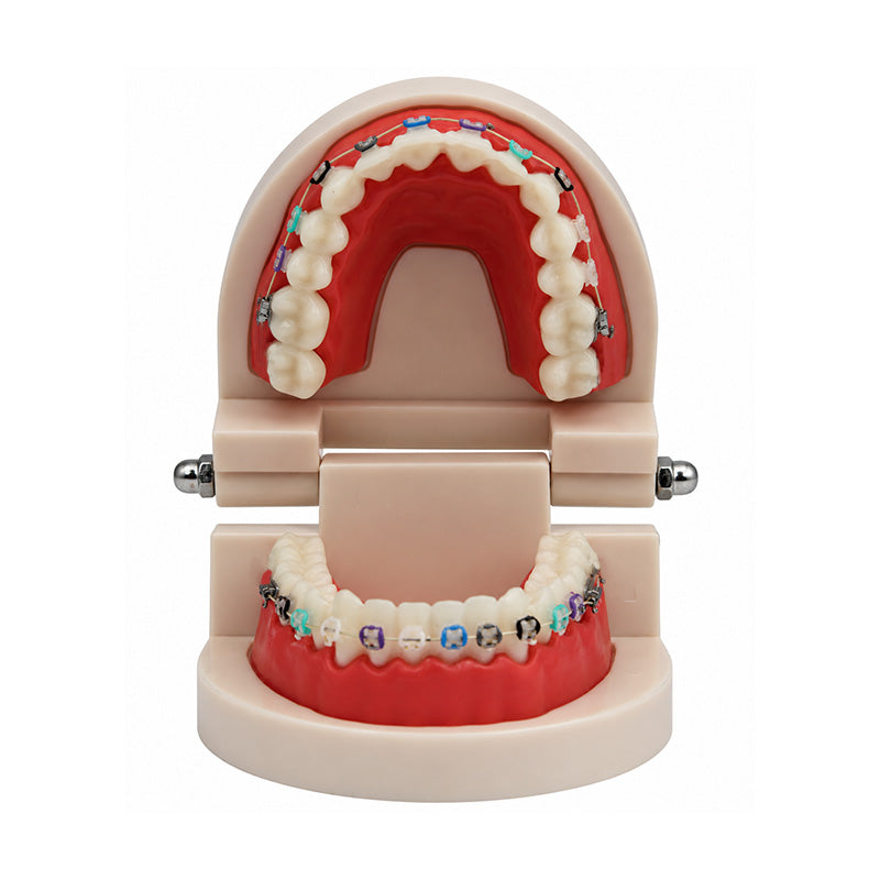Libral Study Model With Axim Ceramic Brackets