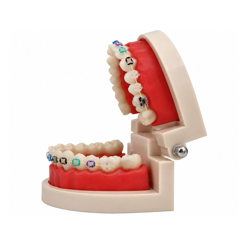 Libral Study Model With Axim Ceramic Brackets