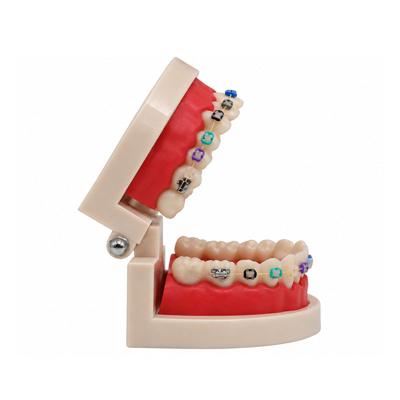 Libral Study Model With Axim Ceramic Brackets