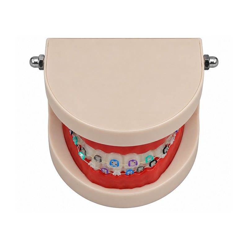Libral Study Model With Axim Ceramic Brackets