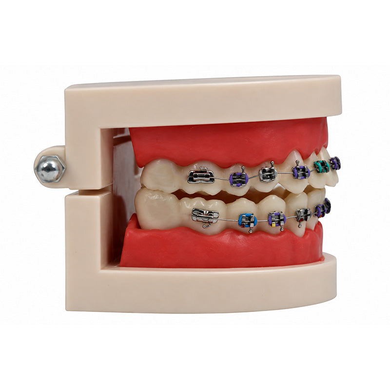 Libral ® dental study model with Leone midi metal brackets showing detailed teeth and orthodontic components.
