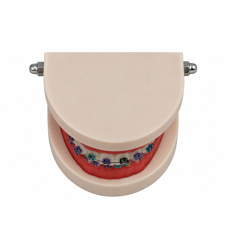 Libral ® dental teeth model with Leone midi - metal brackets used for orthodontic study and demonstration.
