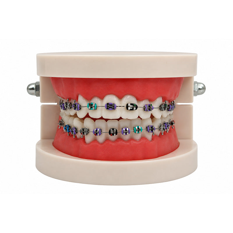 Libral® dental teeth model with Leone midi metal brackets, showing detailed dental anatomy and orthodontic components.