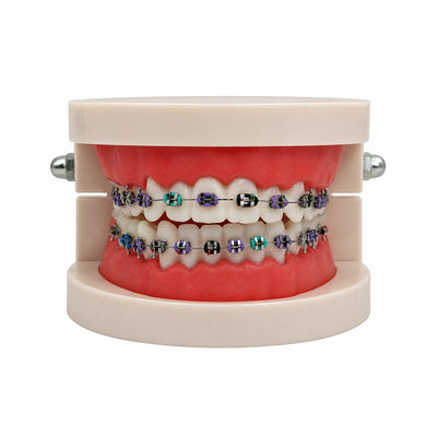 Libral Study Model With Leone Midi - Metal Brackets