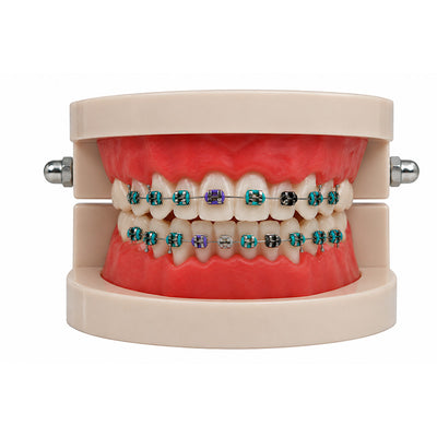 Libral Study Model With Leone Mini - Metal Brackets